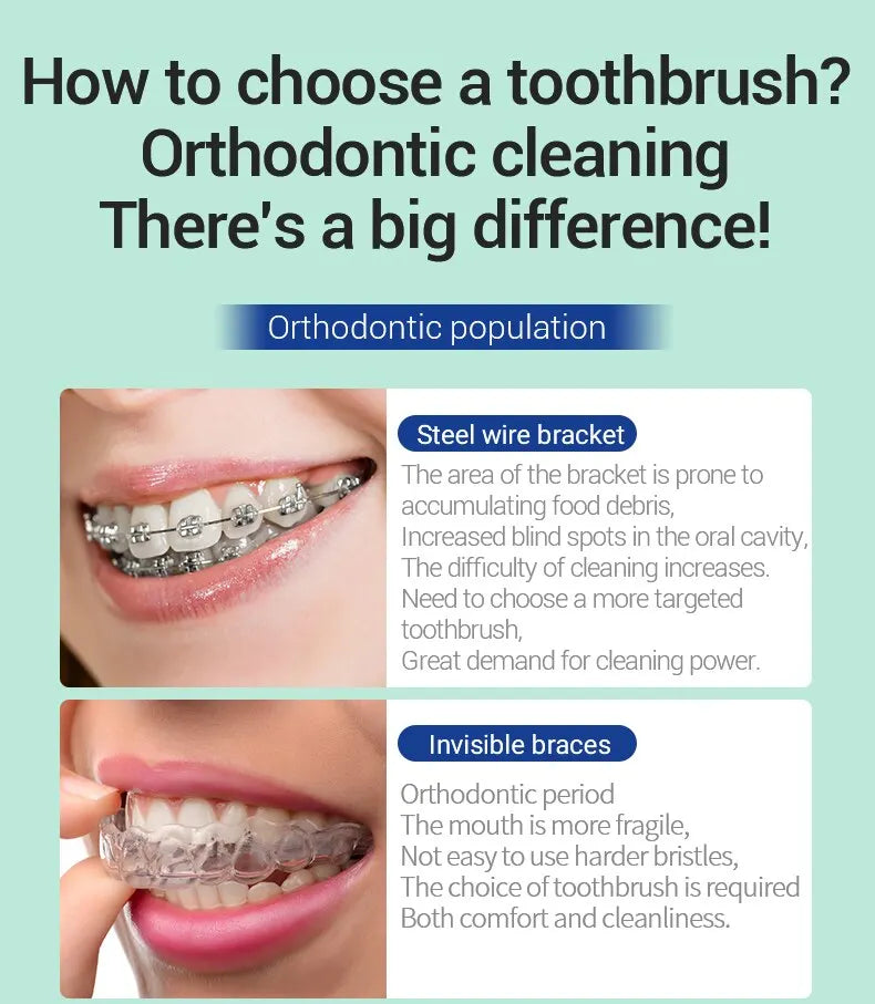 3PC Clean Orthodontic Braces Adult Orthodontic Toothbrushes Dental Tooth Brush Soft Bristle Toothbrush For Oral Health Care